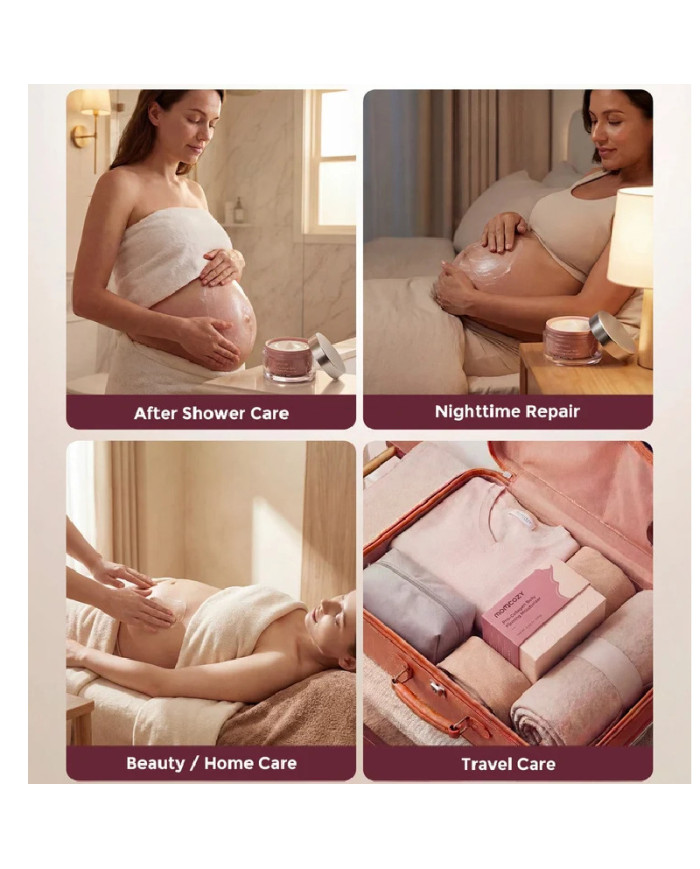 MOMCOZY PRO-COLLAGEN KÕHUNAHKA PINGULDAV KREEM, 150 G